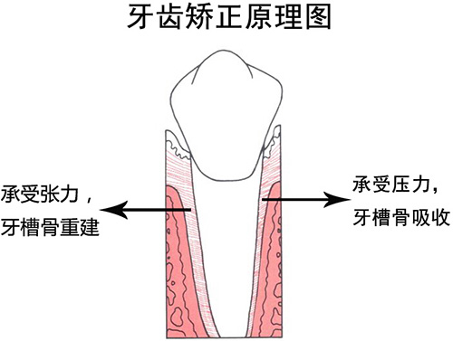 灵魂拷问，到底是先种牙还是先矫正？